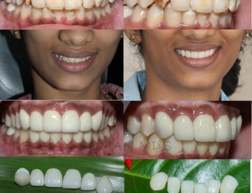 Best Dental Care and Implant center