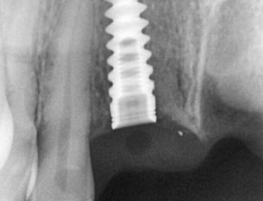 Best Dental Care and Implant center